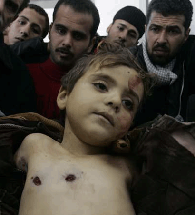 Gaza, Kerugian Sampingan